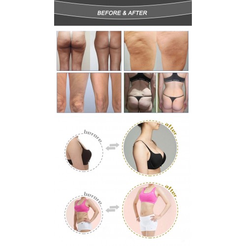 Best Result Vacuum Body Cellulite Therapy / Butt Lifting / Breast Massager Enlargement Machine