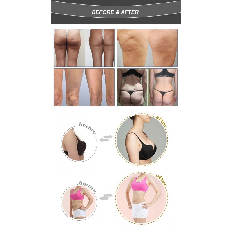 Best Result Vacuum Body Cellulite Therapy / Butt Lifting / Breast Massager Enlargement Machine 